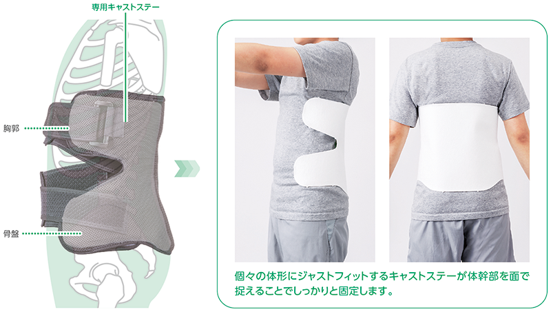 腰椎の「伸展+回旋」を抑制するキャストステー構造