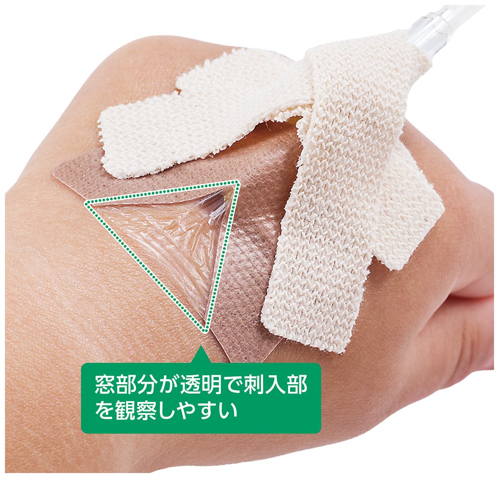 透明なフィルムドレッシング構造の窓部分から刺入部を観察しやすいという製品使用イメージ図