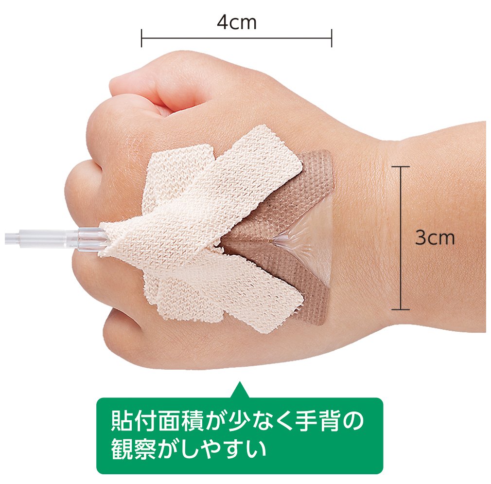 小児の小さな手に配慮したコンパクト設計で貼付面積が少なく手背の観察がしやすい製品使用イメージ図