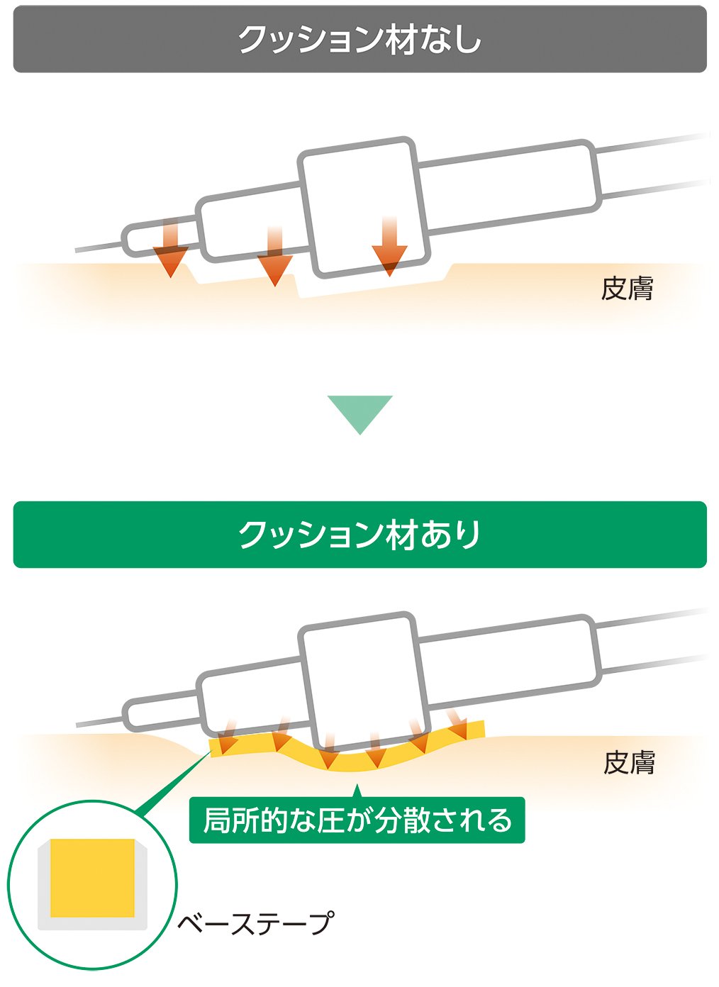クッション材による圧迫分散のイメージ図