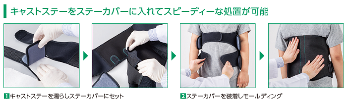キャストステーをステーカバーに入れてスピーディーな処置が可能。装着の流れ画像