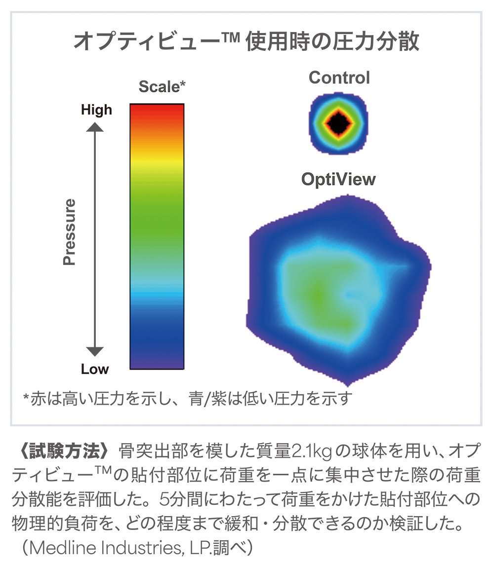 オプティビューを使用した際の荷重分散を評価した図