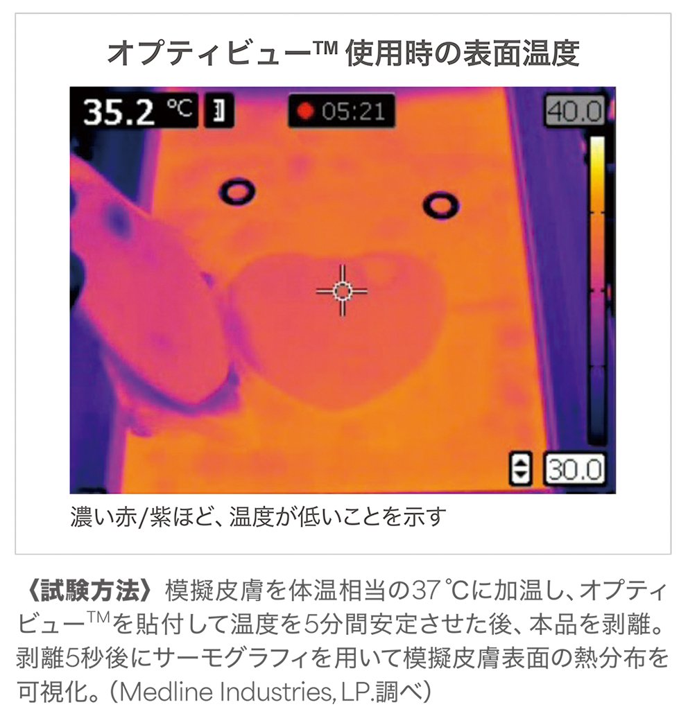 オプティビューを使用した際の模擬皮膚の表面温度の熱分布を可視化した画像