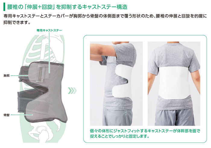 腰椎の伸展＋回旋を抑制するキャストステー構造の画像。