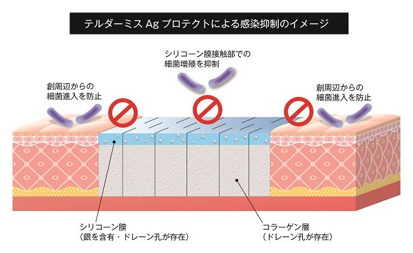 テルダーミスAgプロテクトによる感染抑制のイメージ　創周辺からの細菌侵入を防止し、シリコーン膜接触部での細菌増殖を抑制