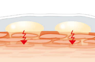 皮膚に付着した尿が与える刺激のイメージ画像です