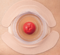 メクレガードテープを2枚貼っている状態