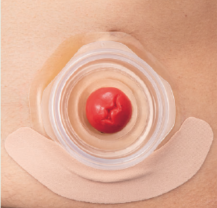 メクレガードテープを1枚貼っている状態