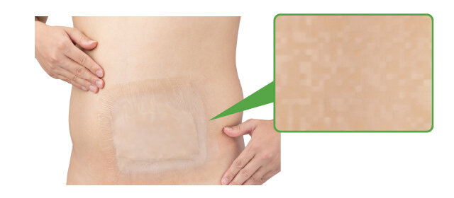 バスラックシールのまだら模様