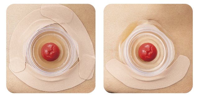 面板の全周を覆ったり気になる箇所に部分使用したりすることができます